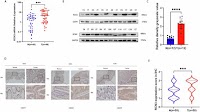 RCN3 functions as a tumor promoter in colorectal cancer by modulating the GRP78-PI3K-AKT signaling pathway