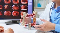 Scientists celebrate bowel cancer breakthrough in bid to tackle surge in young people
