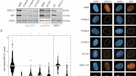 A new multisystem ERCC1-hepatorenal syndrome: insights from a clinical cohort, molecular pathogenesis, and management guidelines | European Journal of Human Genetics
