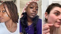 The Best Acne Spot Treatments in 2025, Tested by Editors