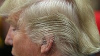 Trump hair viral moments: A look at his haircuts, the part, combover and hiding his bald spot