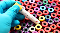 HIV spike stuns Uttarakhand hospital with 477 cases in just 15 months