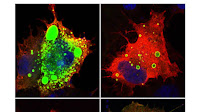 Pan-beta-coronavirus subunit vaccine prevents SARS-CoV-2 Omicron, SARS-CoV, and MERS-CoV challenge