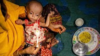 Bangladesh: Rohingya children’s acute hunger surges amid funding cuts
