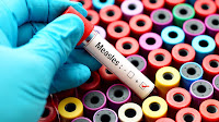 First measles case confirmed in Utah amid national outbreaks