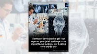 Fact Check: Posts about German gel to help heal damaged joint cartilage greatly exaggerate facts