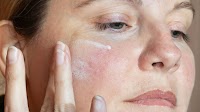 19 Best Products for Rosacea in 2025, According to Derms