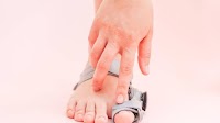 The best bunion correctors of 2025, according to podiatrists