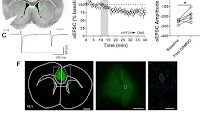 Figure 3. mOP-LTD occurs at medial prefrontal and anterior cingulate...