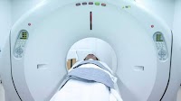 Study highlights cancer risk from millions of CT scans performed annually