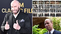 A cure for baldness? Sugar that naturally occurs in the human body stimulates hair growth, scientists discover in breakthrough that could benefit millions of men
