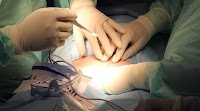 Karnataka doctor leaves surgical mop in woman's stomach during C-section surgery: Report