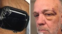 Apple Watch saves life: Washington man credits Apple Watch's fall detection feature for saving father after falling