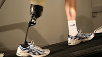 Pressure sensors to help prevent pain for amputees