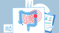 Bevacizumab Combo Appears Effective, Safe for Older Patients With mCRC