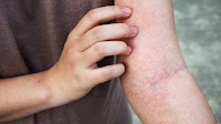 If Your Skin Is Often Itchy Or Inflamed, You Should Check Out This Soothing Cleanser