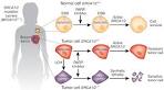 Parp inhibitors for triple negative breast cancer