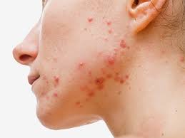 Image result for IUD image