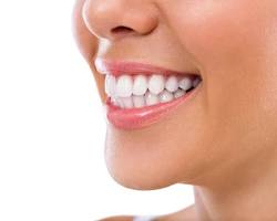Image of person smiling with a bright, white smile