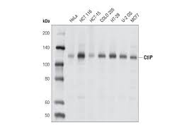 Image result for 9201