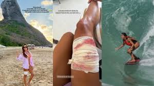 Turista é mordida por tubarão durante mergulho em Fernando de Noronha (PE)