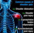 More about Rotator Cuff Injury - Shoulder Pain - HealthCommunities