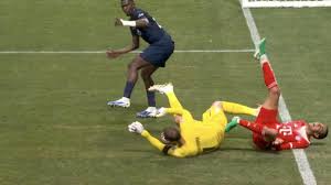 ¡Alarma en el Bayern! Musiala sufre grave lesión tras choque con Donnarumma - Imagen principal del artículo