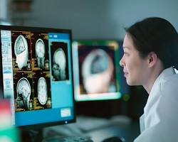 Neurologist