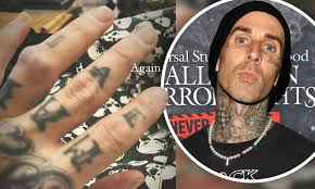 Travis Barker Suffers Hand Injury, Shares Broken Finger on Social Media ‘Again’