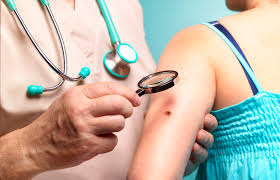 Melanoma Monday and Skin Cancer Awareness: How to Protect Yourself
