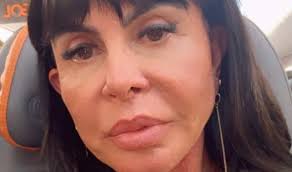 Gretchen fará transplante capilar após receber diagnóstico de alopecia
