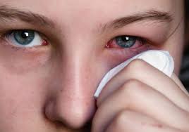 Resultado de imagen para aji en los ojos de niños