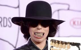 Ternyata Lady Gaga Pakai Gelang di Giginya. Dimitrios Kambouris/Getty Images/AFP; The Cut. Lady Gaga dan gigi palsu dari gelang - gigi-gaga