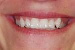 Cours de bijoux dentaire et de blanchiment de dents!Formation