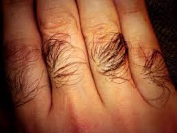Croissance des cheveux terminaux sur les doigts d'une femme