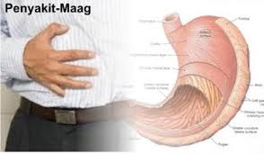 Image result for maag