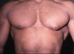 Resultado de imagen para ugly boobs