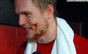 Colin Greening Has Pieces of Fiberglass Removed From Face After Game-Winning Goal (Photo) | Ottawa Senators | NESN.com - colin-greening