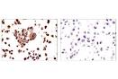 PD-and PD-Lexpression in molecularly selected non-small-cell