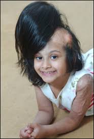 Sidra Afzal kept asking her mother when she would get her hair back - _43040631_sidra300