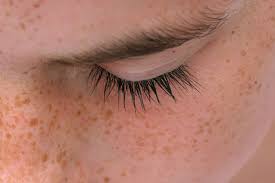 Image result for muka aku jeragat teruk