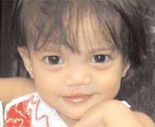 This is Angelica Joy Fabroa of the Philippines after her cleft palate ... - angelica-after