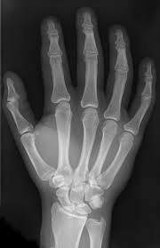 Image result for human hand skeleton