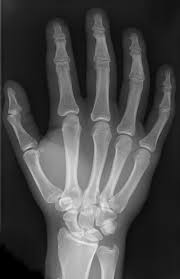 Image result for human hand skeleton