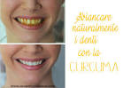 Come Sbiancare i Denti in Modo Naturale - iBright