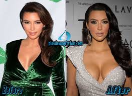 Résultat de recherche d'images pour "who is kim kardashian before and after"