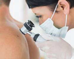 Image of dermatologist examining a patient