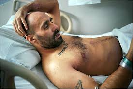 Joao Silva, April 6, 2011. Silva is recuperating at Walter Reed hospital after a land mine exploded under him in Afghanistan while he was taking photographs ... - mag-08lede-t_CA0-articleLarge