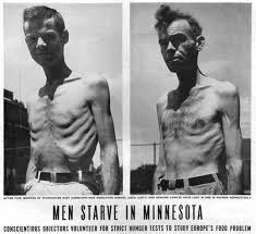 Image result for starving people