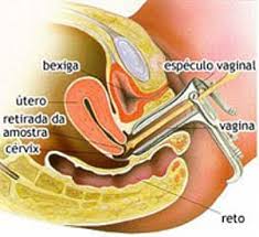 Resultado de imagem para imagem exame citopatológico